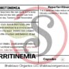 Hyperferritinemia