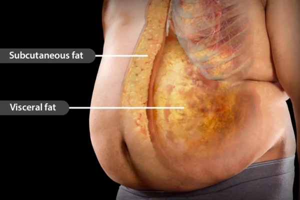 Visceral Fat