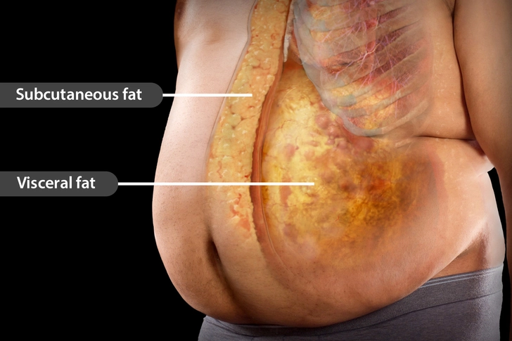 Visceral Fat